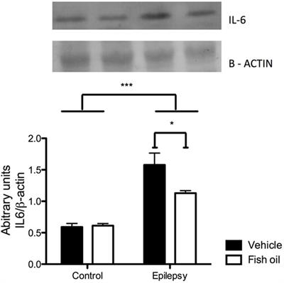 Fish Oil Supplementation Reduces Heart Levels of Interleukin-6 in Rats with Chronic Inflammation due to Epilepsy